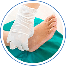 Diabetic Foot