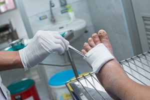 What is a Foot Ulcer?