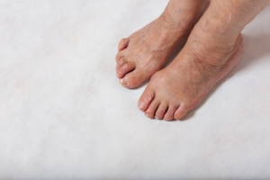 Toe Problems and Deformities