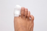 Managing Toe Fractures