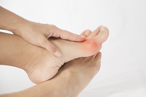 A Bunion May Require Larger Shoes