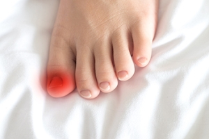 When a Toenail Grows the Wrong Way